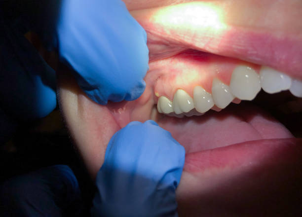 Dentist for Dental Trauma in MD